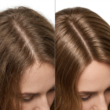 alt+ beauty Hair Power Revitalizing Lotion – Dermatologist-Designed – Reduces Hair Fall, Stimulates Growth, Restores Density – With Redensyl, Procapil & Anagain