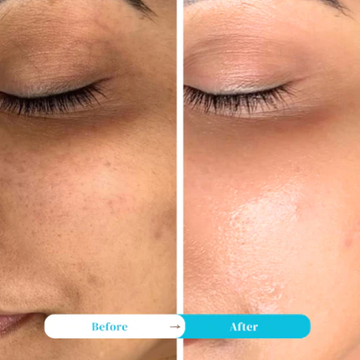 mCaffeine Super Glow Flash Facial Mask | 5-Minute Salon Glow | Removes Tan | Deeply Hydrates