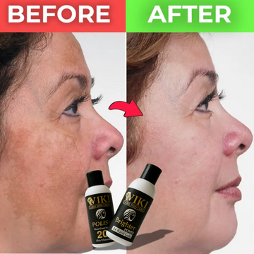 Wiki Special Original Skin Polish - 100% guaranteed whitening Results